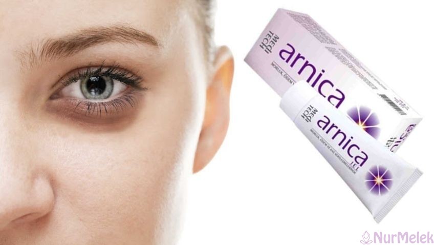 arnica krem kullanımı