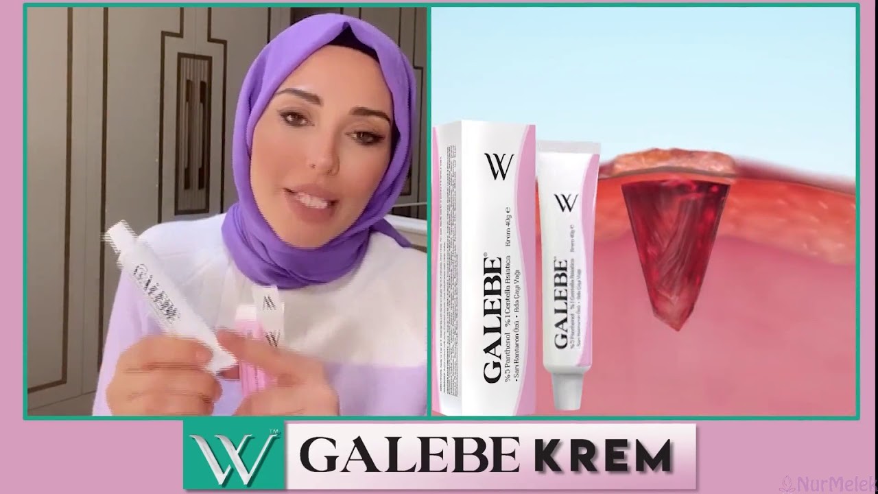 Galebe krem nedir